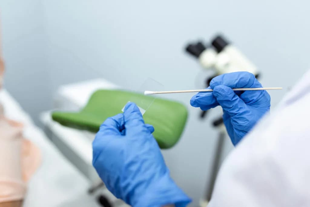 How Often Do You Need a Pap Smear?